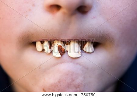 Denti di Halloween