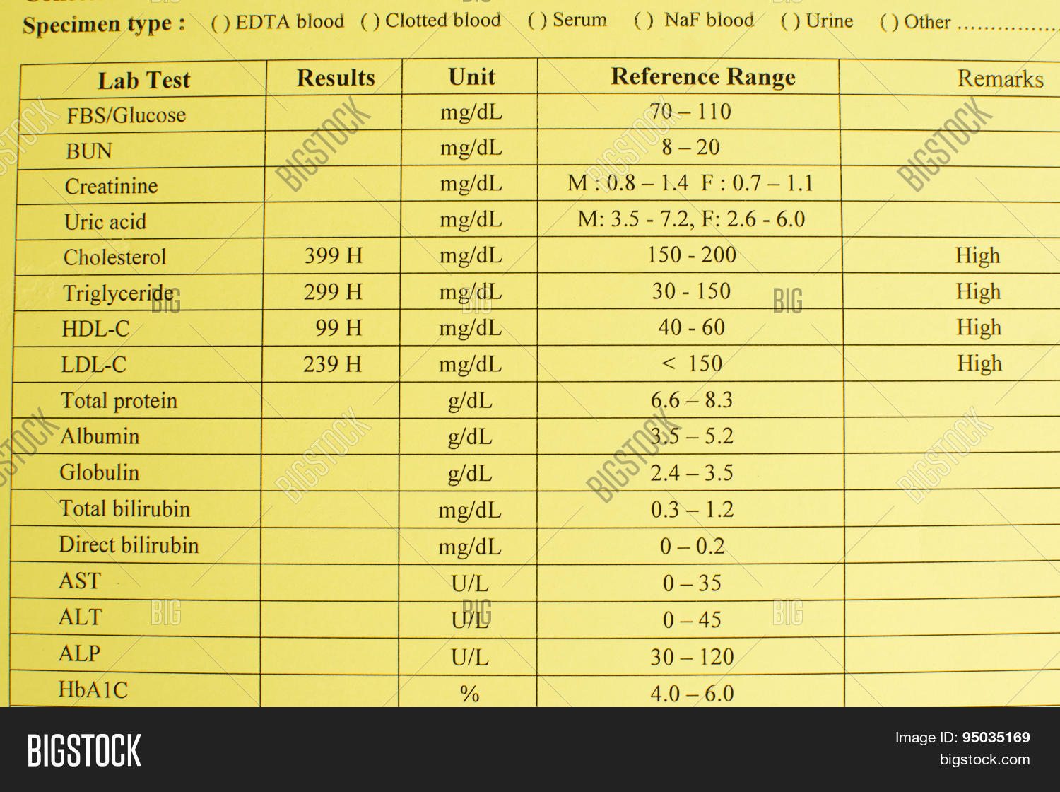 Hight Cholesterol Image & Photo (Free Trial) Bigstock