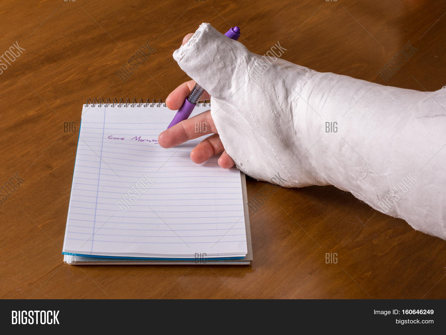Person Arm Cast Image & Photo (Free Trial) Bigstock