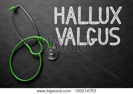 Medical Concept: Top View of Green Stethoscope on Black Chalkboard with Medical Concept - Hallux Valgus. Medical Concept: Hallux Valgus Handwritten on Black Chalkboard. 3D Rendering.
