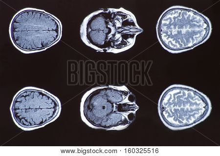 X-ray image of the brain computed tomography, imaging of the brain