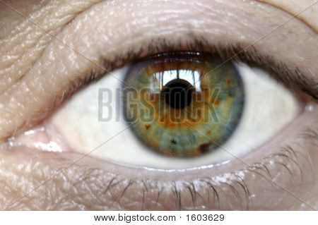 Auge