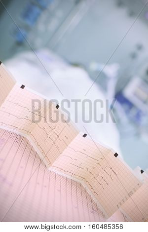 ECG chart on the table in patient ward.