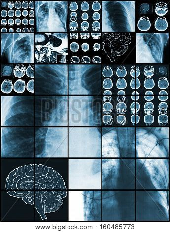 Set of medical test images diagnostics concept.