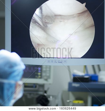 Arthroscopy Surgery Screen