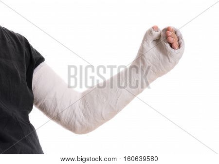 Young Man Wearing A Long Arm Plaster / Fiberglass Cast