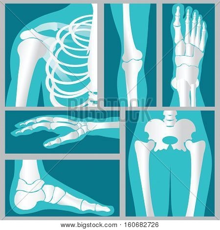 Set of xray of humanhuman jointsknee jointelbow joint ankle joint wrist skeletal spinal bone structure of Human Spine emblem or sign of medical diagnostic center flat vector illustration.