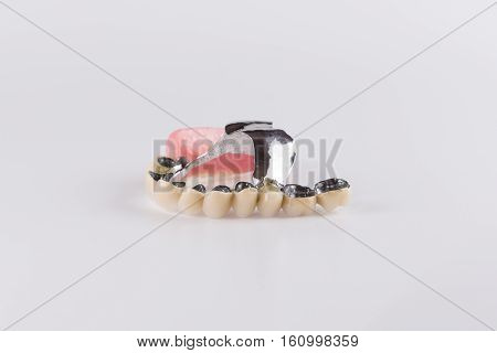 Clasp prosthesis with and attachments fixing ceramic crowns