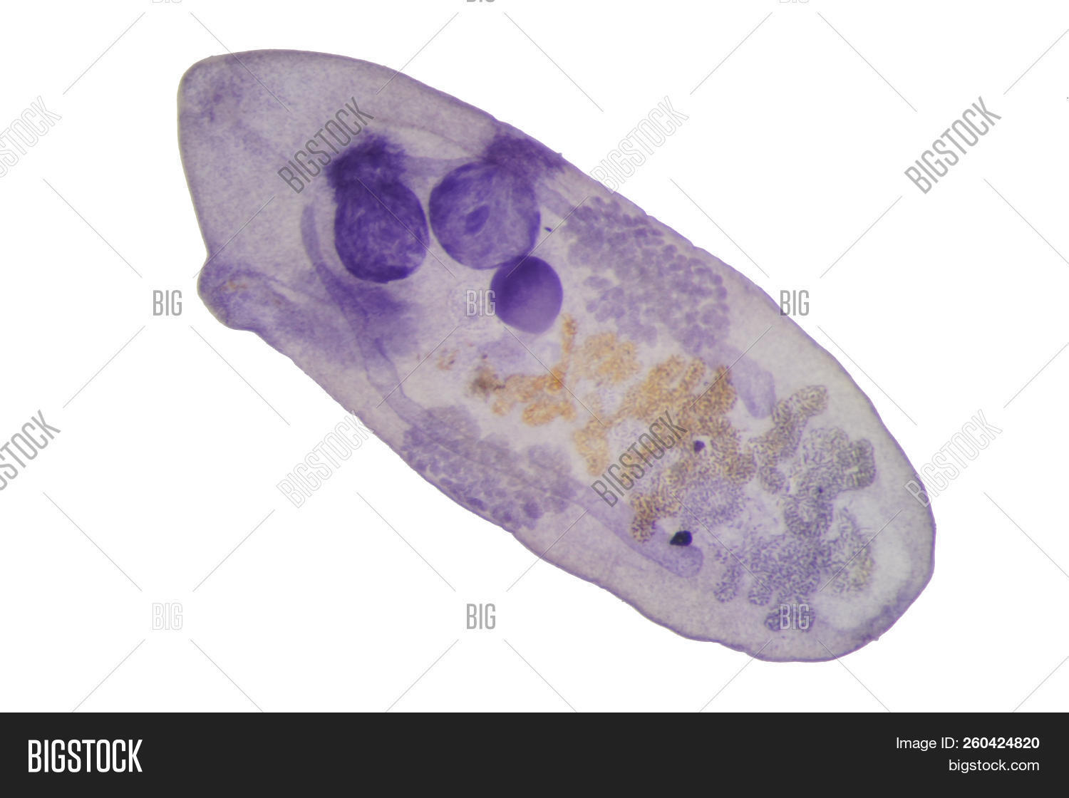 Fluke Parasite >> Liver Fluke Parasitic Image Photo Free Trial Bigstock Fluke Parasite >> Liver Fluke Parasitic Image Photo Free Trial Bigstock