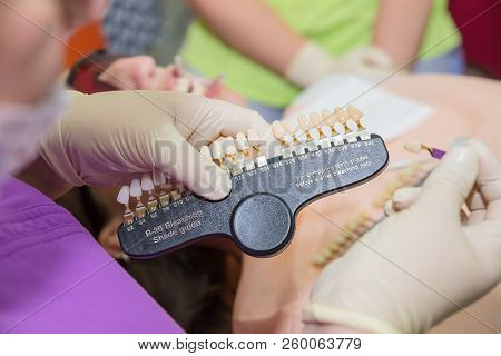 Beautiful Smile And White Teeth. Matching The Shades Of The Implants Or The Process Of Teeth Whiteni