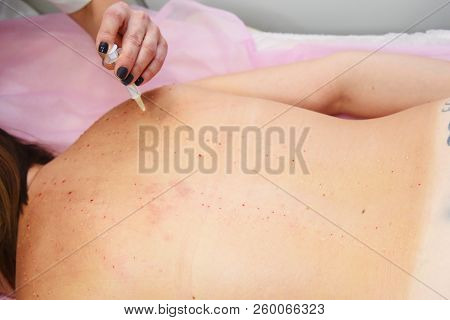 Beauty injections in the salon. The procedure for skin tightening and rejuvenation.