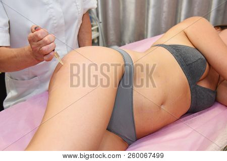 Beauty Injections In The Salon. The Procedure For Skin Tightening And Rejuvenation.