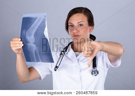 Portrait Of A Young Female Doctor With Knee X-ray Gesturing Thumbs Down
