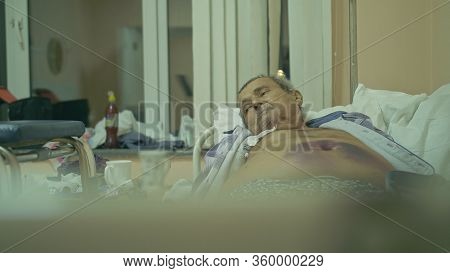 The Patient Is 72 Years Old. Extensive Polyarthritis. Surgery Hip Fracture. Real Russian Hospital Di