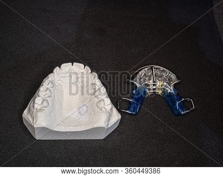 Temporary Retainers On White Plaster Cast. Retainers Are Important After Braces.