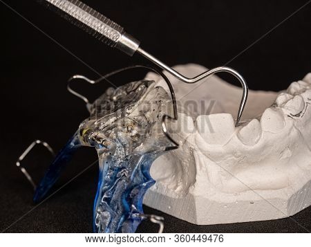 Temporary Retainers On White Plaster Cast. Retainers Are Important After Braces.