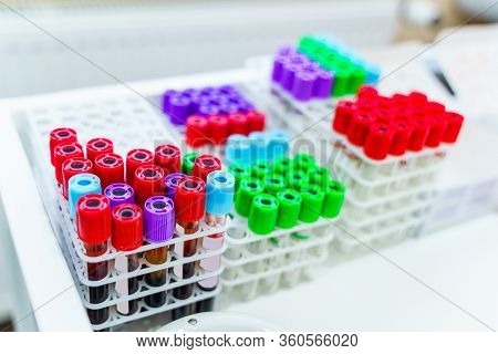 Testing In Laboratory. Tubes With Blood. Chemical Research. Prevention. Pneumonia Diagnosing. Covid-