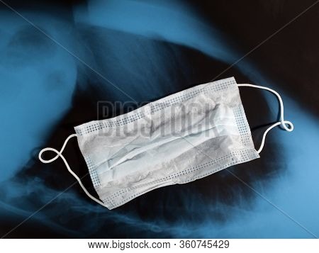 Medical Ear-loop Mask On Blue Black X-ray Image Background. Protection Concept