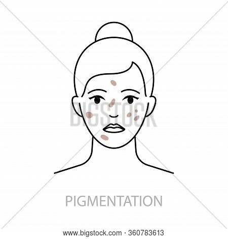 Skin Pigmentation Disorders Vector Icon Line Style