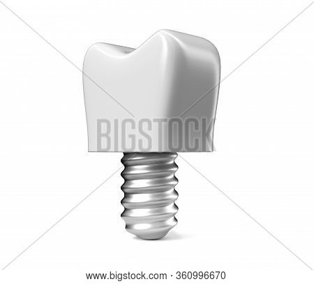 3d Render White Tooth Implant Denture Icon Set Closeup Isolated On White Background. Dental, Medicin