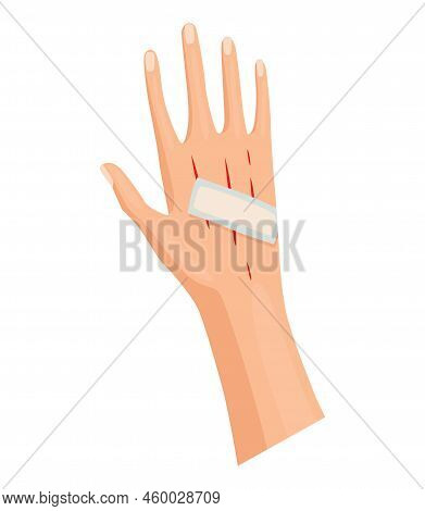 Hands Injured Skin And Procedures Of Bandaging. First Aid For Wound. Medicine Cure Or Treatment. Fir