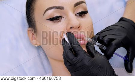 Medical Office, Doctor In Black Sterile Gloves, Injecting Hyaluronic Acid Into The Patient Lips. Pro