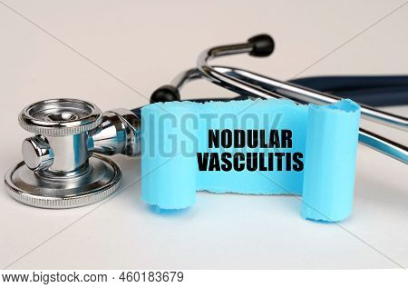 Medical Concept. On A White Surface Lies A Stethoscope And A Blue Roll Of Paper With The Inscription