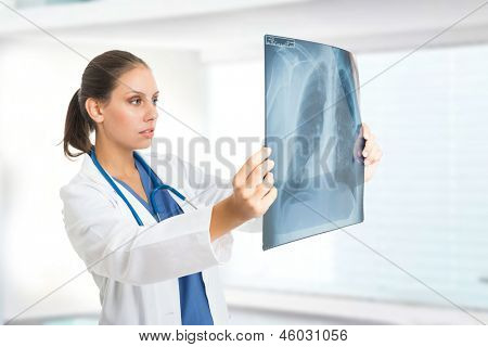 Female doctor examining a lung radiography