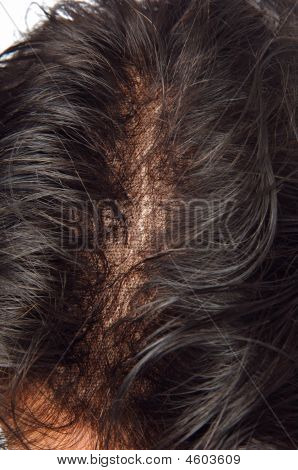 Toupee