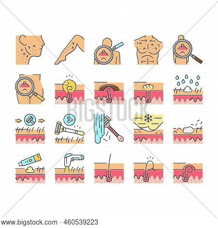 Ingrown Hair Problem Treatment Icons Set Vector. Ingrown Hair Shaving And Depilation With Laser Elec
