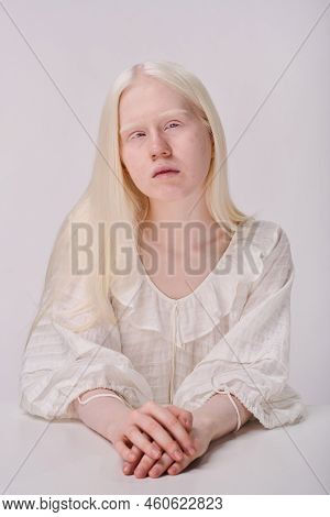 Portrait Of Young Girl Having Albinism In Elegant Dress Looking At Camera Against White Background