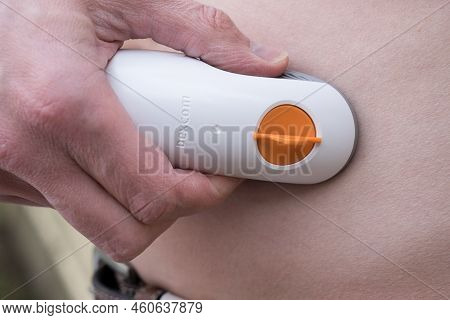 Sydney, Australia - 2022-07-31 Cgm - Continuous Glucose Monitoring: Dexcom G6 Sensor Installationon