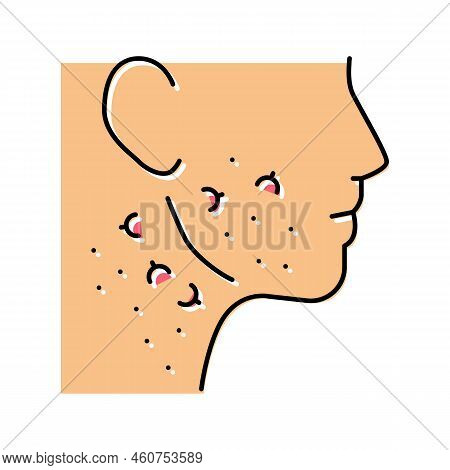 Face Neck Ingrown Hair Color Icon Vector. Face Neck Ingrown Hair Sign. Isolated Symbol Illustration