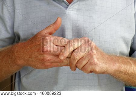 Close-up Of Mature Caucasian Males Left Hand Massaging The Fingers Of His Right Hand To Ease Any Pai