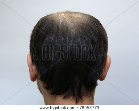 men's hair