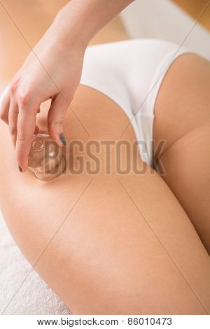 Beautician Using Chinese Cupping