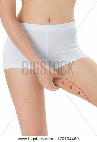 Woman grabbing skin on her Inner thigh with the red color crosses marking Lose weight and liposuction cellulite removal concept Isolated on white background.