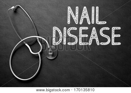 Medical Concept: Nail Disease - Medical Concept on Black Chalkboard. Black Chalkboard with Nail Disease - Medical Concept. 3D Rendering.