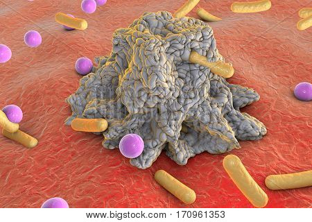 Phagocytosis. Macrophage engulfing bacteria of different shapes, 3D illustration