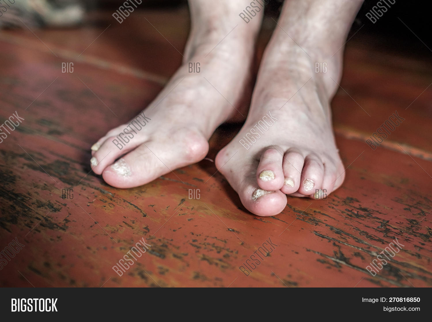 Barefoot Which Have Image Photo Free Trial Bigstock