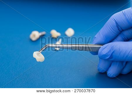 A Dentist Is Holding Tweezers For Dental Ceramic Veneers And Crowns. Closeup Hand In Blue Glove