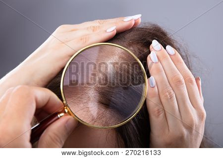 Dermatologist Examining Woman's Hair