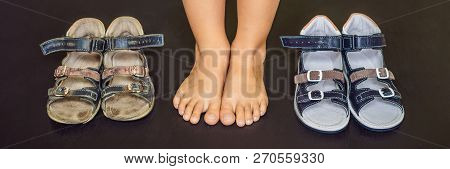 Old And New Childrens Orthopedic Shoes. Thomas Heel, Arch Support Banner, Long Format