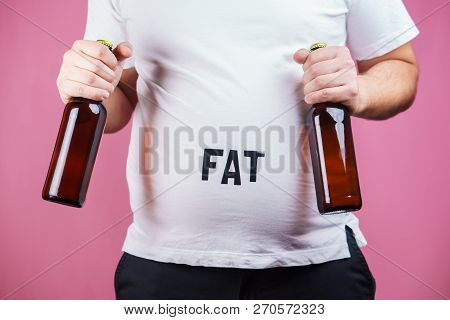 Overeating, Estrogen Level, Excess Food, Glutton, Alcohol Addiction, Junk Food. Fat Obese Man With T