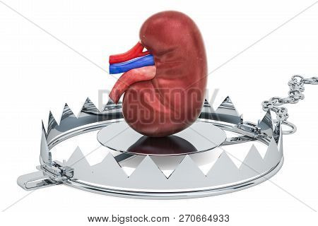 Kidney Pain Concept. Human Kidney Inside Bear Trap. 3d Rendering Isolated On White Background