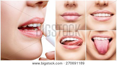 Collage With Perfect Female Lips. Woman Applying Lipbalm.