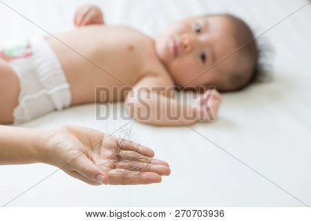 New Moms Notice Hair Loss Around Three Months Postpartum And The Hormonal Changes That Accompany Bir