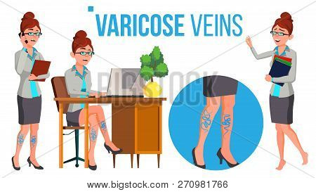 Female Legs In High Heel Shoes With Varicose Veins Vector. Isolated Cartoon Illustration