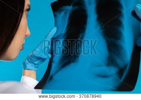 The Pulmonologist Checks The Patients Lungs For Any Disturbing Changes.