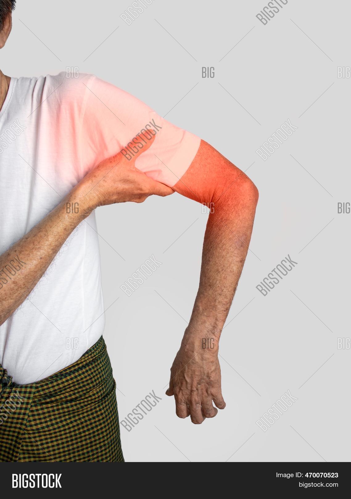 Pain Upper Arm Image & Photo (Free Trial) Bigstock